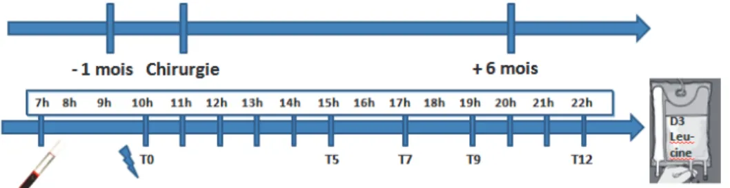 Figure  4 :  Détail  de  chaque  étape  1  mois  avant  chirurgie  et  à  6  mois  de  la  chirurgie
