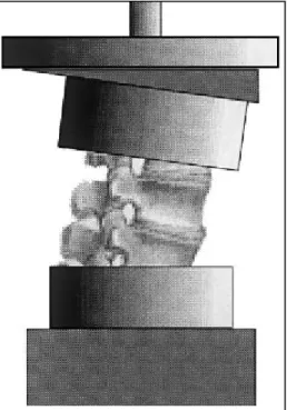 Figure 1.7 Méthode pour imposer un angle de flexion à un segment de colonne   Adaptée de Panjabi et coll