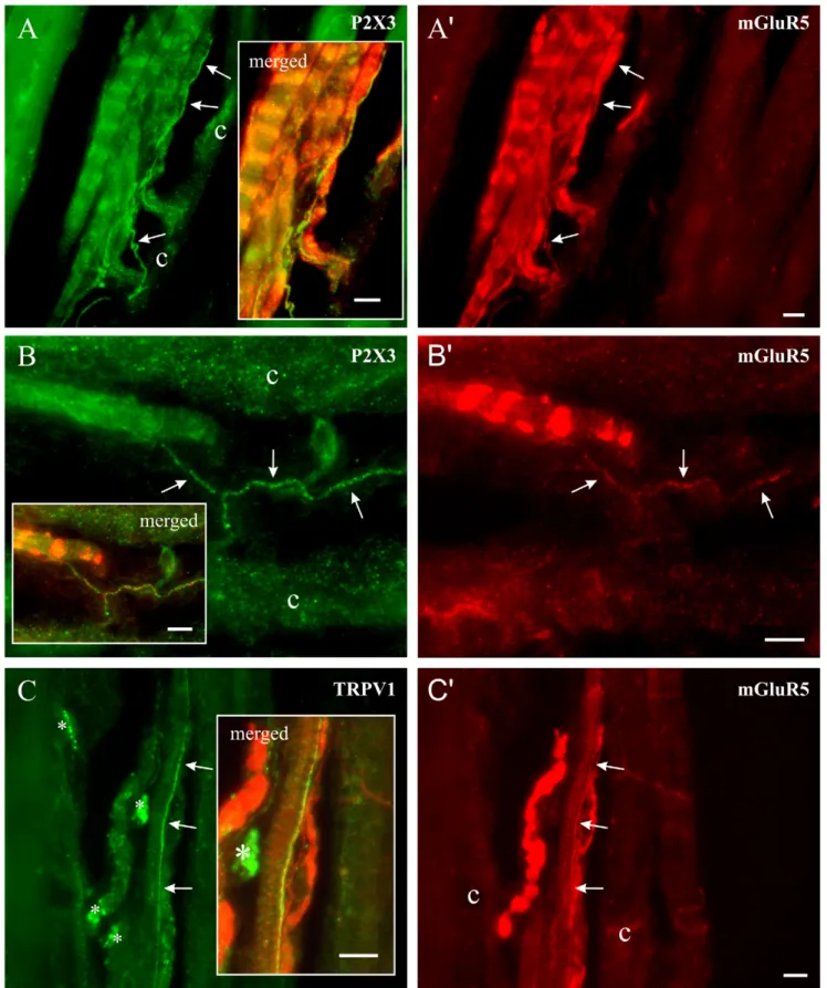 Figure 6. The putative nociceptors in muscle spindles carry mGluR5 receptors. In all cases, the photomicrographs from the left and right columns have the exact same frames but with different set of fluorescence filters