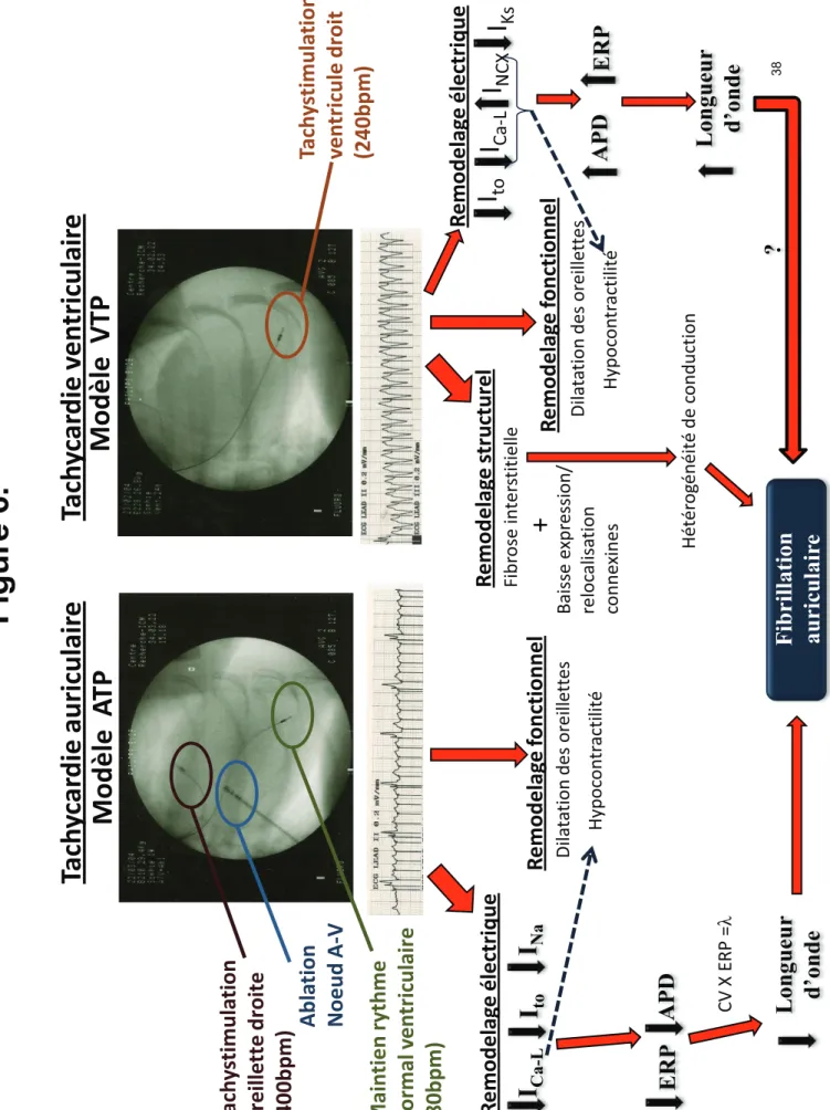 Figure 6. Modèle  ATP Ablation NoeudA-V