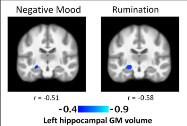 FIGURE 1 | T-Statistic maps of the negative association between regional left hippocampal gray matter volume and daily negative mood and rumination.