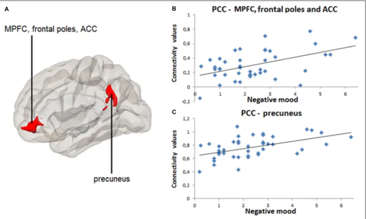 FIGURE 2 | Positive correlation between daily negative mood and resting-state connectivity between posterior cingulate cortex (PCC) and medial prefrontal cortex (MPFC), frontal poles, anterior cingulate cortex (ACC), as well as between PCC and precuneus