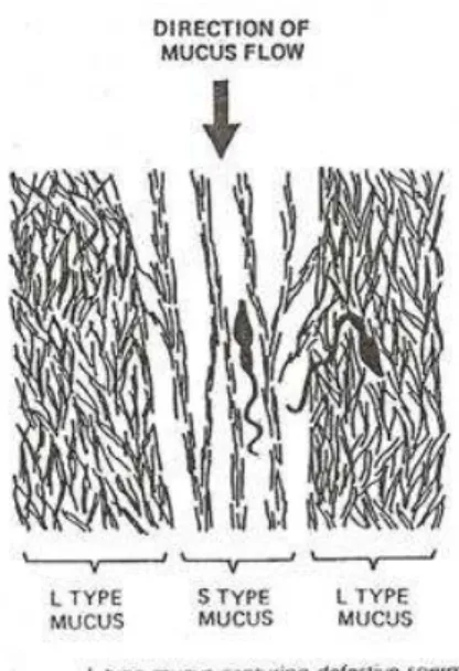 Figure 3. Glaire L et S (16) 