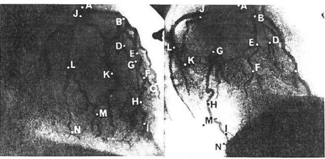 FIG. 3.2. Exemple de coronarographie biplan avec identification des points de bifurcations vasculaires
