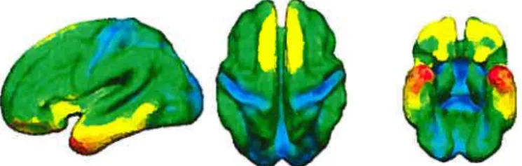 FiG. 1.6 — coordonnée moyenne du cerveau Automatisation du diagnostic et de ta thérapie