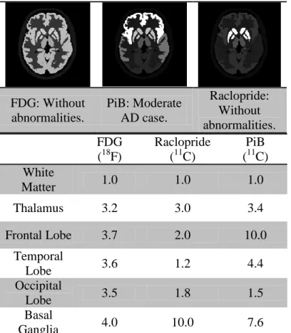 Table  2  :  Relative  activity  distributions  based  on  commonly  used  radiopharmaceuticals