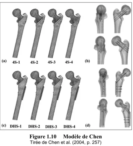 Figure 1.10  Modèle de Chen 