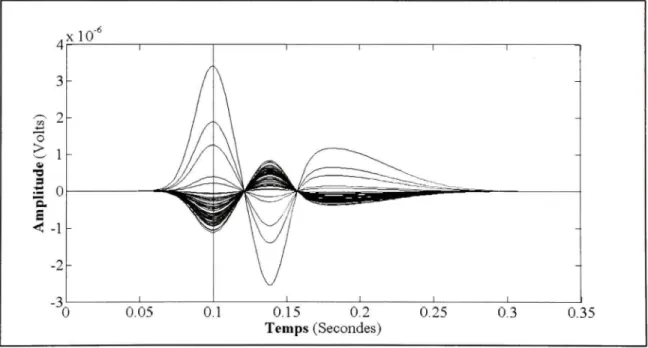 Figure 3.2 Un exemple d'une pointe EEG simulé à l'aide d'une source unique. 