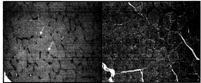 Figure  1.3.  Différence  de  morphologie  entre  des  fibres  musculaires  saines  (A)  et  nouvellement régénérées suite  à  une lésion  à  la cardiotoxine (10 jours après la lésion)  (B)