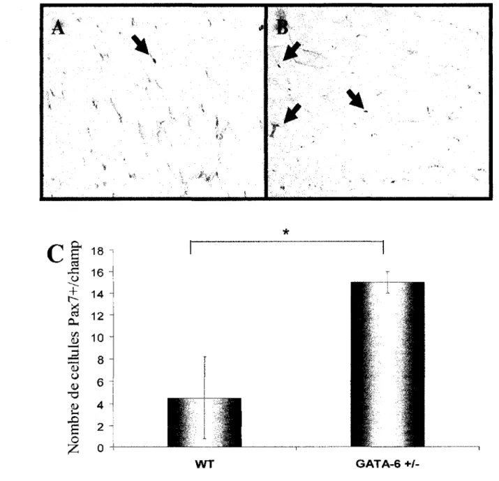 Figure 3.4 Les souris haploinsuffisante en GATA-6 possèdent 