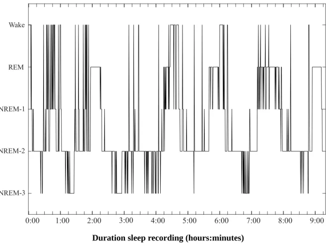 Figure 3.1: Hypnogram of one participant. Example of sleep pattern of one participant