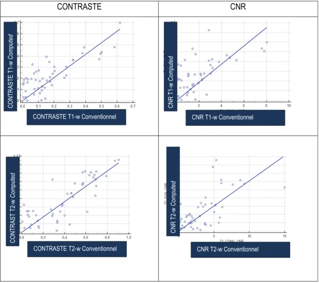 Figure 13 : Régressions linéaires du contraste et du CNR – conventionnel vs computed – Toutes les  régions 