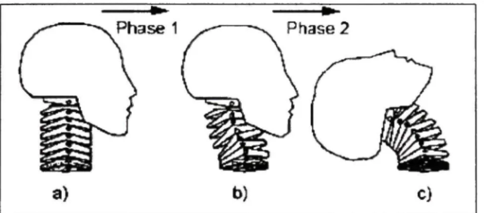 Figure 1.8 Mouvement initial du cou et de la tête lors d'une  collision arrière. 