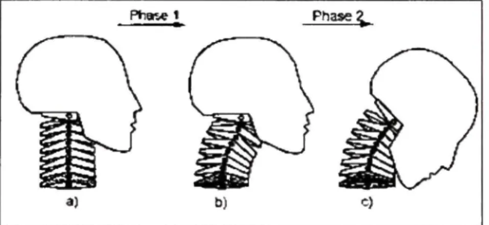 Figure 1.9 Mouvement du cou et de la tête lors du rebond  d'une collision arrière. 