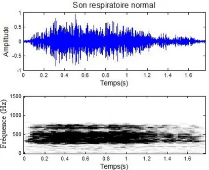 Figure 0.1: Repr´esentation dans le domaine temps (haut) et sous forme de spectrogramme (bas) d’un son respiratoire normal.