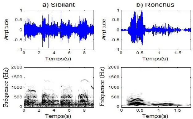 Figure 0.2: Repr´esentation dans le domaine temps et sous forme de spectrogramme de sons respiratoires adventices continus : a) sibilant et b) ronchus.