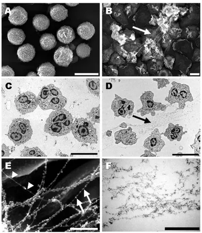 Figure  3:  Analyse par  microscopie  électronique  d’un polynucléaire  neutrophile  à  l’état  quiescent et activé