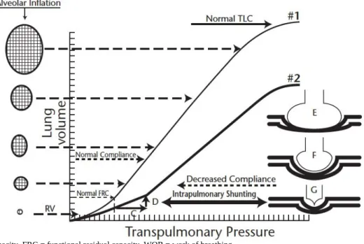 Figure   4   :  représentation   de   la   compliance   pulmonaire   moindre   chez   l’enfant   prématuré (courbe 2) avec diminution de la capacité résiduelle fonctionnelle et du rapport ventilation / perfusion 