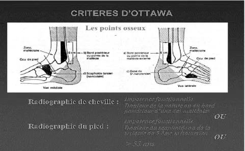 Figure 3 : Schéma explicatif des critères d’Ottawa 