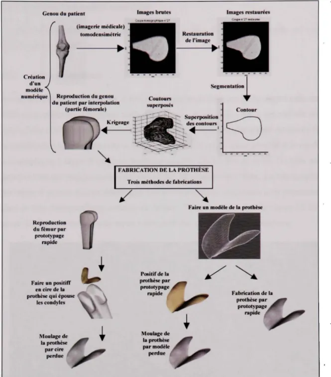 Figure 2.1 Schématisatio n des étapes de production d'une prothèse personnalisée. 