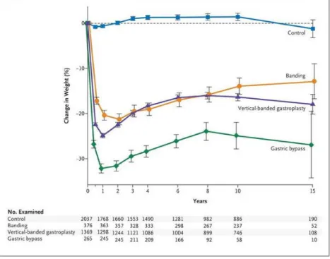 Figure  10 -    Etude  SOS  –  Perte  de  poids  à  15  ans  selon  les  différentes  techniques  chirurgicales 