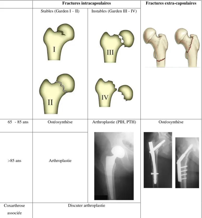 Figure  1 :  Résumé  des  indications  chirurgicales  selon  les  recommandations  HAS  « Chirurgie  des  fractures de l’extrémité proximale du fémur chez les patients âgés » 2016  