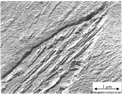 Figure 0.4 : Bainite observée au microscope  0.2.1.3-La martensite  