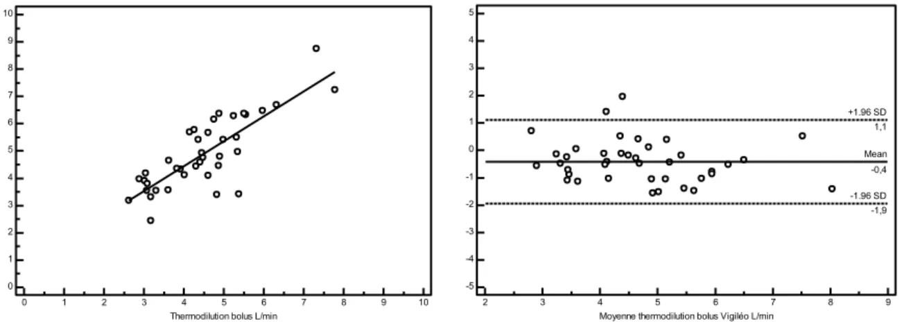 Figure  3 :  graphique  de  régression  linéaire  et  Bland  et  Altman  pour  la  méthode  de  thermodilution par bolus versus Vigiléo 