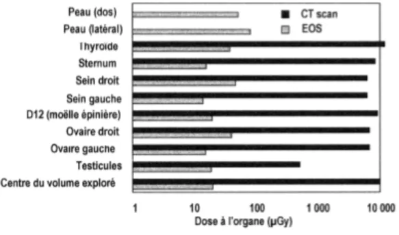 Figure 6. Dose à l’organe EOS versus TDM. 