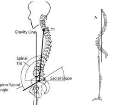 Figure 10. Représentation de l’angle spino-sacré (spino-sacral angle) et C7 pump line (A) 