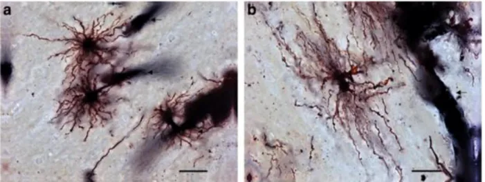 Fig. 3. Protoplamic and fibrous astrocytes in human brain. (a) Protoplasmic astrocytes, found in gray matter (cingulate  cortex shown above), have rich branched processes, surrounding a large number of synapses; (b) fibrous astrocytes,  characteristic to w