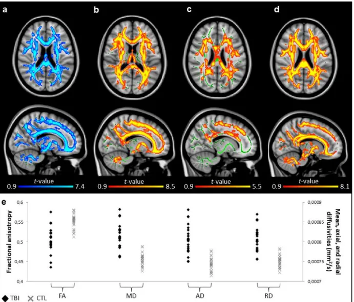 FIGURE  1.  Group  differences  on  diffusion  metrics.  TBSS  voxel-wise  contrasts  between  traumatic brain injury (TBI) and control (CTL) groups (blue, TBI &lt; CTL; red to yellow, TBI &gt; 