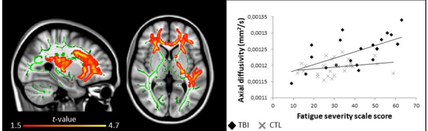 FIGURE 6. Self-reported fatigue and white matter damage.  Areas  in traumatic  brain  injury  (TBI) group where fatigue is correlated (red to yellow, positive correlation) with axial diffusivity  (r = 0.66)