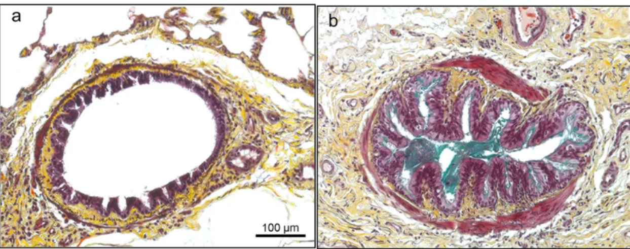 Figure 7.  Non-asthmatic (a) and asthmatic (b) bronchial sections of two horses stained with  modified  Russel-Movat  Pentachrome