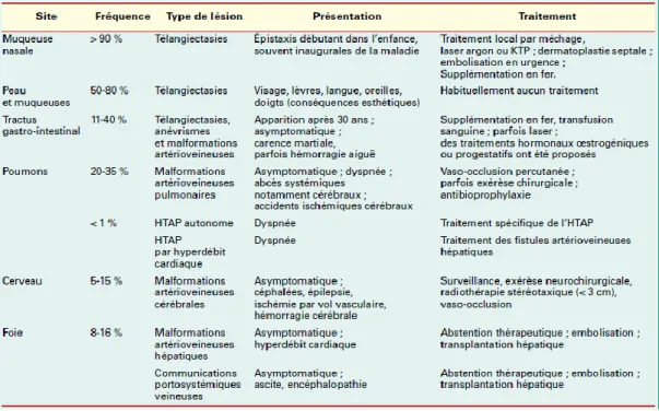Tableau 1 : Aspects cliniques de la MRO, la fréquence et le traitement d’après Cottin (24)