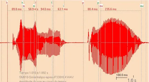 Figure 12 : Allure temporelle du mot /Tralipau/ avec contrastes plus nets, et une bonne séparation /a-i- au/ (SM010 après) 