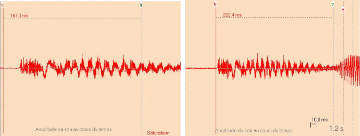 Figure 14 : Ajustement des frontières (ici le segment /tr/) à l’aide l’allure temporelle 
