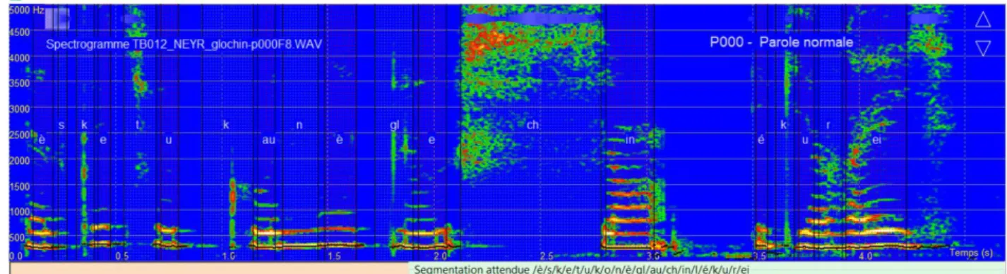 Figure 8 : Spectrogramme et segmentation de la phrase « Est-ce que tu connais Glochin l’écureuil ? », fille de 8 ans parole  normale 