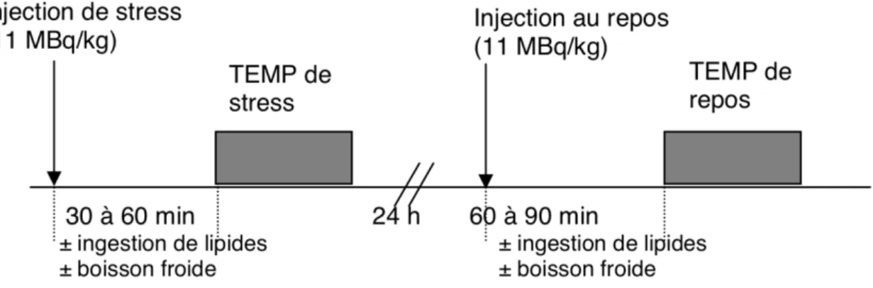 Figure 8. Acquisitions stress puis repos sur 2 jours, d’après la SFMN « Guide pour la rédaction de  protocoles pour la tomoscintigraphie de perfusion myocardique »