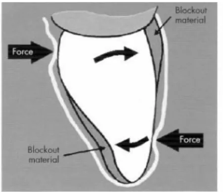 Figure 9 : Mouvement de translation 