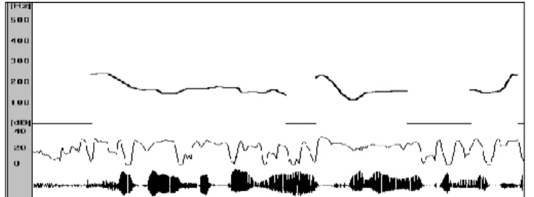 Figure  1 :  Représentation  des  paramètres  prosodiques  avec,  de  bas  en  haut,  le  signal  acoustique,  l’intensité en décibels, et la f0 en hertz (les zones non voisées sont repérées par des valeurs nulles) ; en  abscisse : le temps