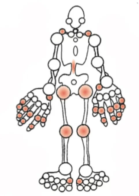 Figure 1. L’arthrose est une pathologie qui touche les articulations. Les principales parties  du corps touchées par l’arthrose sont le genou, la hanche, la colonne vertébrale, la main et  le pied