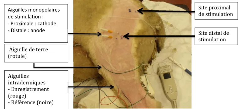 Figure 3. Montage pour mesurer la vitesse de conduction nerveuse motrice.