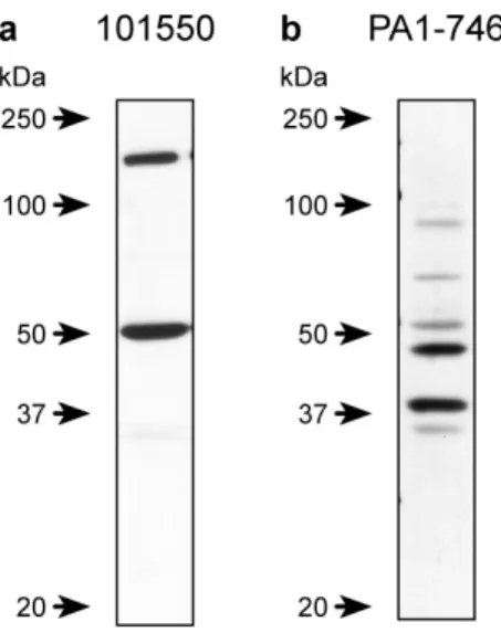 Figure 3.3 Lot to lot variability with CB2R antibodies. 