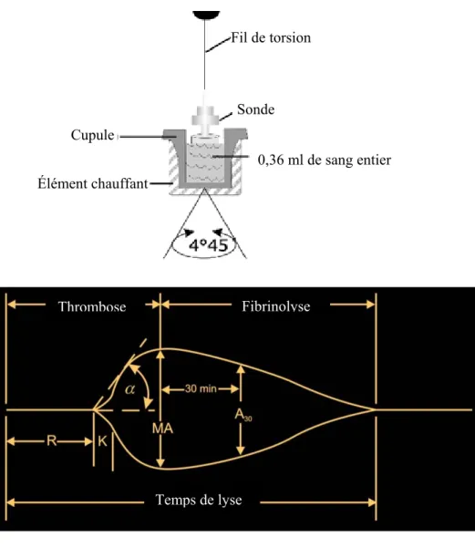 Figure 5 : Schématisation de l’appareil et du tracé TEG® 