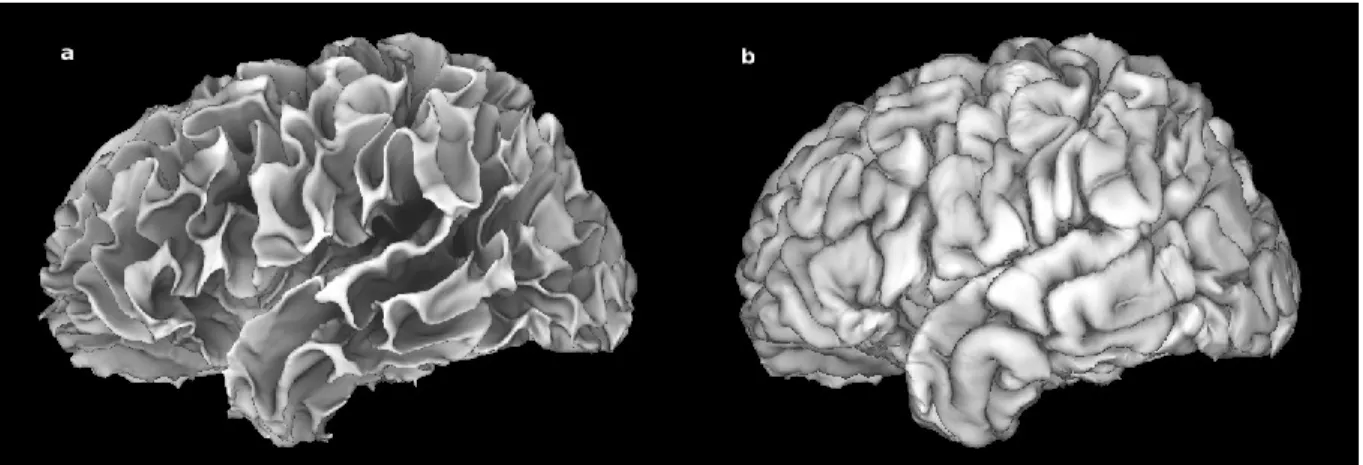 Figure 6 – Surfaces corticales; a : interface matière blanche / cortex; b : face externe du cortex