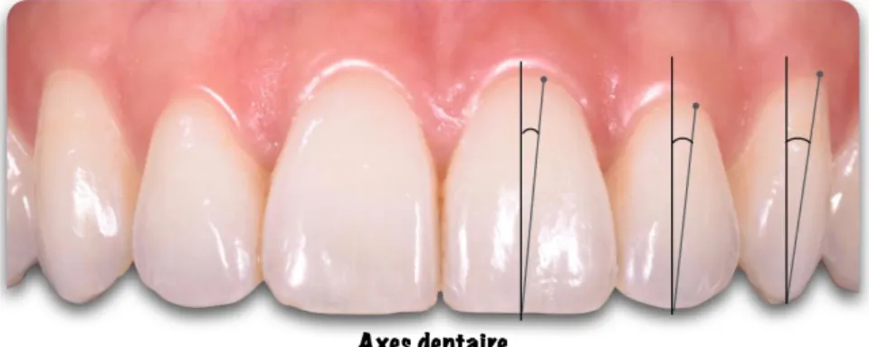 Figure 7 : Axes dentaires. 