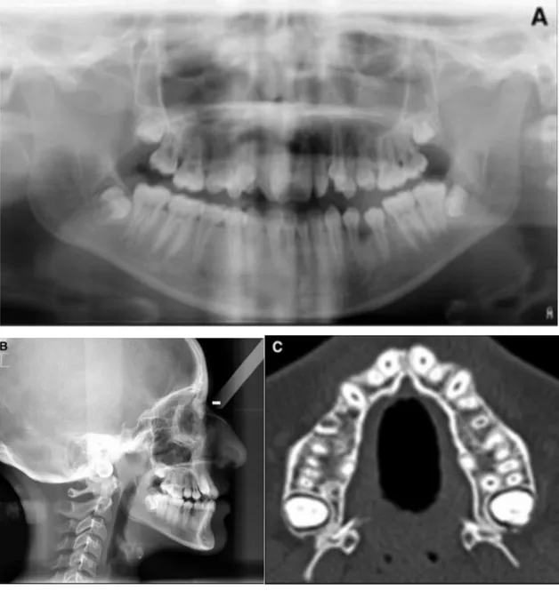 Figure 17 : Documents du bilan pré-orthodontique (radiographies) 