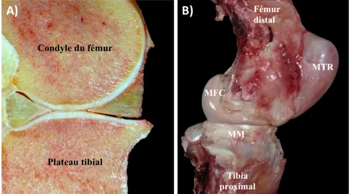 Figure 4 : Apparence méniscale macroscopique in situ du ménisque médial. A) Coupe sagittale au centre du plateau  tibial  médial  (corne  crâniale  située  à  gauche)