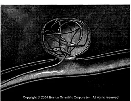 Figure 4  Cathéter et un coil 